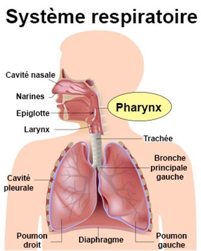 Tumeur du pharynx