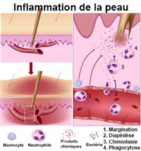 Peau Sommaire Recherche Docteurclic Com