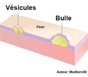 Vésicules : définition - docteurclic.com