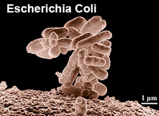 Escherichia coli infection urinaire : Comment diagnostiquer une cystite ?