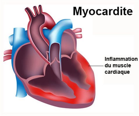 contraction du muscle cardiaque