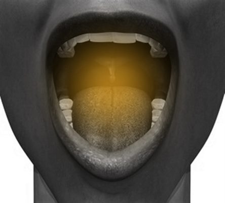 Les morsures des joues et de la langue. — Conseil Dentaire Dr