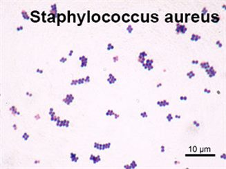 staphylococcus aureus