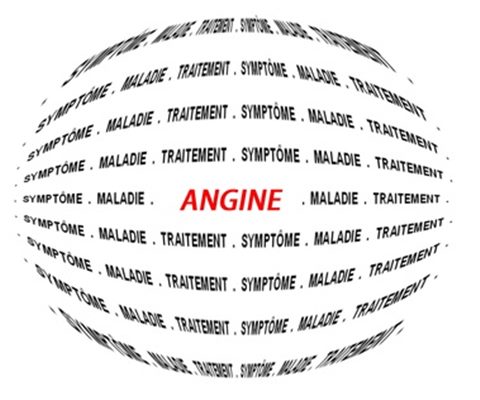 Angine Symptomes Traitement Definition Docteurclic Com