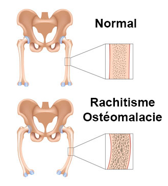 Ost Omalacie Sympt Mes Traitement D Finition Docteurclic Com   Image 4478 