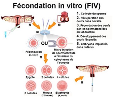 Fécondation in vitro définition technique docteurclic com