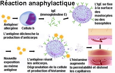 réaction anaphylactique